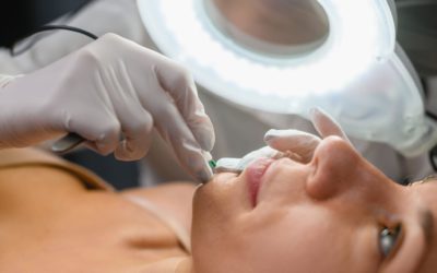 Surgical Hair Removal Services in Fairfax VA: A Smooth Solution to Unwanted Hair